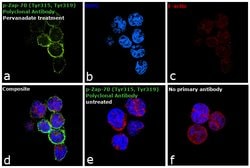 Invitrogen Phospho-Zap-70 (Tyr315, Tyr319) Recombinant Rabbit Monoclonal Antibody (4H16L19) 100 &mu;g | Buy Online | Invitrogen&trade; | Fisher Scientific