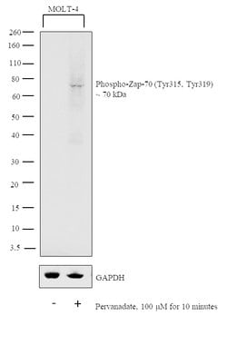 Invitrogen Phospho-Zap-70 (Tyr315, Tyr319) Recombinant Rabbit Monoclonal Antibody (4H16L19) 100 &mu;g | Buy Online | Invitrogen&trade; | Fisher Scientific