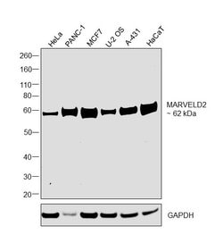 Invitrogen MARVELD2 Recombinant Rabbit Monoclonal Antibody (54H19L38) 100