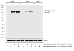 Phospho-STAT6 (Tyr641) Recombinant Rabbit Monoclonal Antibody (46H1L12):Antibodies,