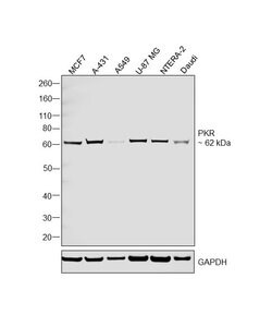 Invitrogen PKR Recombinant Rabbit Monoclonal Antibody (23H52L96) 100 &mu;g | Buy Online | Invitrogen&trade; | Fisher Scientific