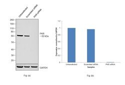 Invitrogen PKR Recombinant Rabbit Monoclonal Antibody (23H52L96) 100 &mu;g | Buy Online | Invitrogen&trade; | Fisher Scientific