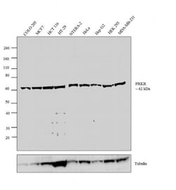 Invitrogen PKR Recombinant Rabbit Monoclonal Antibody (23H52L96) 100 &mu;g | Buy Online | Invitrogen&trade; | Fisher Scientific