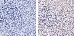 RIG-I Recombinant Rabbit Monoclonal Antibody (35H2L48):Antibodies, Recombinant