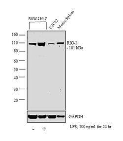 RIG-I Recombinant Rabbit Monoclonal Antibody (35H2L48):Antibodies, Recombinant