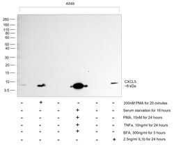 Invitrogen CXCL5 Recombinant Rabbit Monoclonal Antibody (9H45L5) 100 &mu;g;
