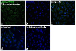 Invitrogen LC3B Recombinant Rabbit Monoclonal Antibody (2H30L32), Alexa Fluor Plus 488 50 &mu;L | Buy Online | Invitrogen&trade; | Fisher Scientific
