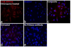 Invitrogen LC3B Recombinant Rabbit Monoclonal Antibody (2H30L32), Alexa Fluor Plus 555 50 &mu;L | Buy Online | Invitrogen&trade; | Fisher Scientific