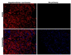Invitrogen EGFR Recombinant Rabbit Monoclonal Antibody (30H45L42) 100 &mu;g;