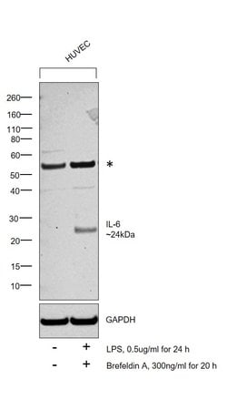 Invitrogen IL-6 Recombinant Rabbit Monoclonal Antibody (4H16L21) 100 &mu;g;