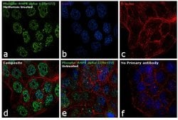 Phospho-AMPK alpha-1,2 (Thr183, Thr172) Recombinant Rabbit Monoclonal Antibody