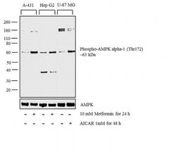 Phospho-AMPK alpha-1,2 (Thr183, Thr172) Recombinant Rabbit Monoclonal Antibody