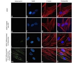 Invitrogen Adiponectin Recombinant Rabbit Monoclonal Antibody (11H4L4)