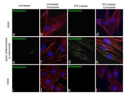 Invitrogen Adiponectin Recombinant Rabbit Monoclonal Antibody (11H4L4)