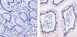 MCP-2 Recombinant Rabbit Monoclonal Antibody (3H18L3), Invitrogen 100 &mu;g;