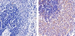 Invitrogen CXCL10 Recombinant Rabbit Monoclonal Antibody (10H11L3) 100