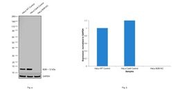 Invitrogen beta-2 Microglobulin Recombinant Rabbit Monoclonal Antibody
