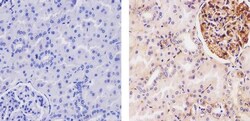 Invitrogen beta-2 Microglobulin Recombinant Rabbit Monoclonal Antibody