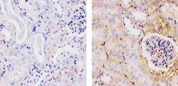 Invitrogen beta-2 Microglobulin Recombinant Rabbit Monoclonal Antibody