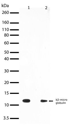 Invitrogen beta-2 Microglobulin Recombinant Rabbit Monoclonal Antibody