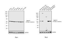 Invitrogen MMP16 Recombinant Rabbit Monoclonal Antibody (13H7L7) 100 &mu;g | Buy Online | Invitrogen&trade; | Fisher Scientific