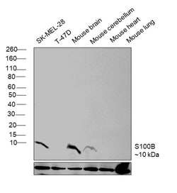 Invitrogen S100B Recombinant Rabbit Monoclonal Antibody (16H24L21) 100