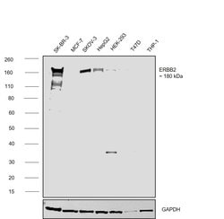 Invitrogen ErbB2 (HER-2) Recombinant Rabbit Monoclonal Antibody (7H3L20)