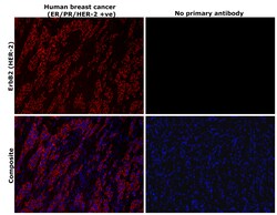 Invitrogen ErbB2 (HER-2) Recombinant Rabbit Monoclonal Antibody (7H3L20)