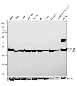 Invitrogen Cyclin D1 Recombinant Rabbit Monoclonal Antibody (17H3L3) 100