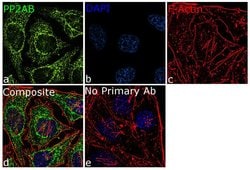 Invitrogen PPP2R2A Recombinant Rabbit Monoclonal Antibody (1H3L5) 100 &mu;g;