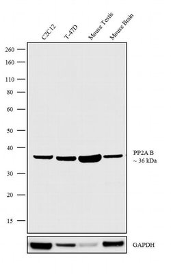 Invitrogen PPP2R2A Recombinant Rabbit Monoclonal Antibody (1H3L5) 100 &mu;g;