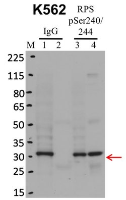Invitrogen Phospho-S6 (Ser240, Ser244) Recombinant Rabbit Monoclonal Antibody