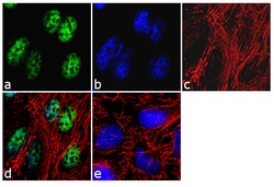 Invitrogen KMT2D Recombinant Rabbit Monoclonal Antibody (9H13L17) 100 &mu;g | Buy Online | Invitrogen&trade; | Fisher Scientific