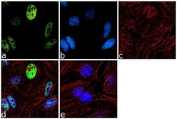Invitrogen RNF20 Recombinant Rabbit Monoclonal Antibody (10H23L1) 100 &mu;g;