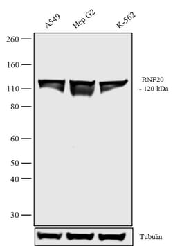 Invitrogen RNF20 Recombinant Rabbit Monoclonal Antibody (10H23L1) 100 &mu;g;