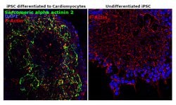 Invitrogen alpha Actinin 2 Recombinant Rabbit Monoclonal Antibody (7H1L69)