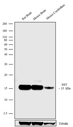 Invitrogen Somatostatin Recombinant Rabbit Monoclonal Antibody (9H33L7) 100 &mu;g | Buy Online | Invitrogen&trade; | Fisher Scientific