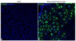 Invitrogen OTX2 Recombinant Rabbit Monoclonal Antibody (14H14L5) 100 &mu;g;