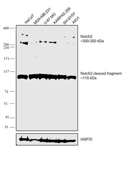 Invitrogen NOTCH2 Recombinant Rabbit Monoclonal Antibody (18H4L20) 100