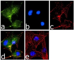 Invitrogen NOTCH2 Recombinant Rabbit Monoclonal Antibody (18H4L20) 100