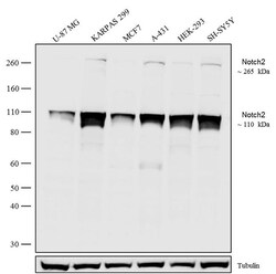 Invitrogen NOTCH2 Recombinant Rabbit Monoclonal Antibody (18H4L20) 100