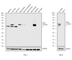 Invitrogen TPH2 Recombinant Rabbit Monoclonal Antibody (9H1L6) 100 &mu;g | Buy Online | Invitrogen&trade; | Fisher Scientific