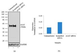 Invitrogen alpha-1 Antitrypsin Recombinant Rabbit Monoclonal Antibody (8H10L18)