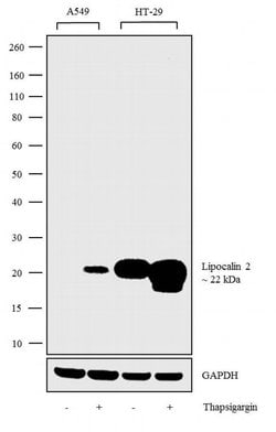 Invitrogen NGAL Recombinant Rabbit Monoclonal Antibody (11H10L7) 100 &mu;g;