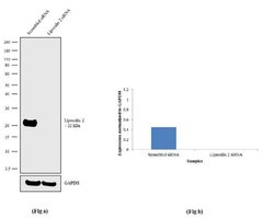 Invitrogen NGAL Recombinant Rabbit Monoclonal Antibody (11H10L7) 100 &mu;g;