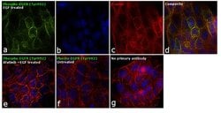 Invitrogen&trade;&nbsp;Phospho-EGFR (Tyr992) Recombinant Rabbit Monoclonal Antibody (3H24L5)
