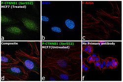 Invitrogen&trade;&nbsp;Phospho-beta Catenin (Ser552) Recombinant Rabbit Monoclonal Antibody (1H29L24)