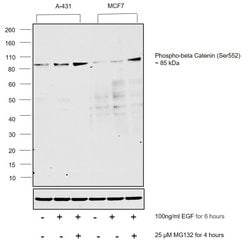 Invitrogen Phospho-beta Catenin (Ser552) Recombinant Rabbit Monoclonal Antibody (1H29L24) 100 &mu;g | Buy Online | Invitrogen&trade; | Fisher Scientific