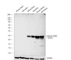 Invitrogen Calbindin D28K Recombinant Rabbit Monoclonal Antibody (5H25L2) 100 &mu;g | Buy Online | Invitrogen&trade; | Fisher Scientific