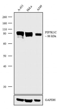 Invitrogen PIP5K1C Recombinant Rabbit Monoclonal Antibody (16H4L5) 100